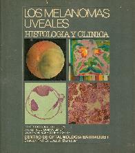 Los melanomas uveales