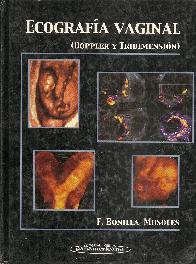 Ecografia Vaginal Dopler y tridimensional