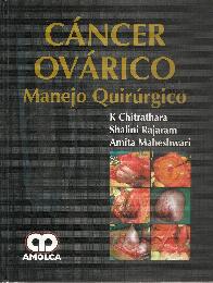 Cncer ovrico