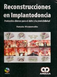 Reconstrucciones en implantodoncia