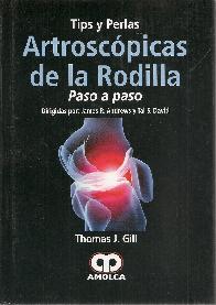 Artroscpia de la Rodilla. Tips y Perlas