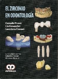 El zirconio en Odontologa