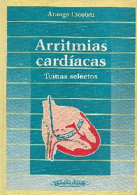 Arritmias cardiacas