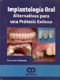 Implantologa Oral