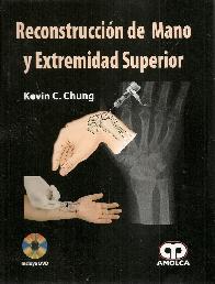 Reconstruccin de Mano y Extremidad Superior