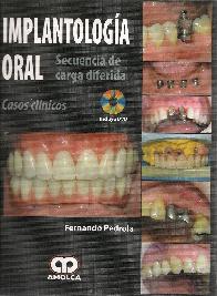 Implantologa oral