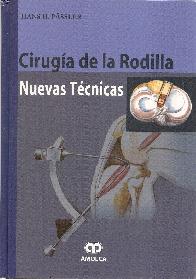 Ciruga de la Rodilla