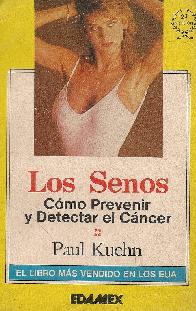 Los senos: prevenir y detectar el cancer