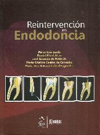 Reintervencin en Endodoncia