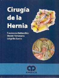 Ciruga de la Hernia