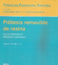 Prtesis removible de resina