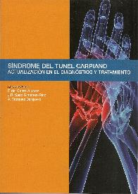Sndrome del tunel carpiano.
