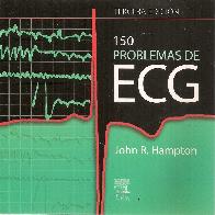 150 problemas de ECG