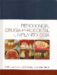 Periodoncia, ciruga periodontal e implantologa