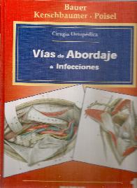 Vas de abordaje e infecciones - Volumen 1