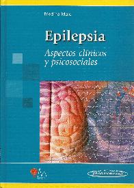 Epilepsia