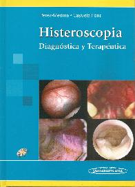 Histeroscopia
