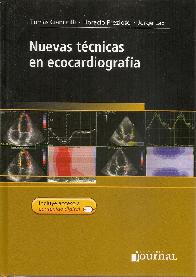 Nuevas tcnicas en ecocargrafa