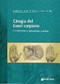 Ciruga del Tunel Carpiano