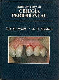 Cirugia periodontal