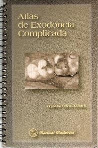 Atlas de exodoncia complicada