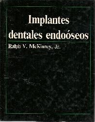 Implantes dentales endooseos