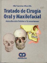 Tratado de Ciruga Oral y Maxilofacial