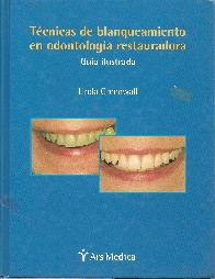Tcnicas de blanqueamiento en odontologa restauradora