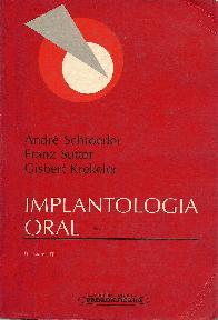 Implantologia oral