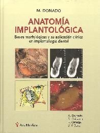 Anatomia Implantológica