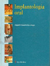 Implantologia oral