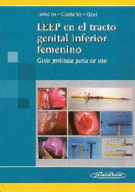 LEEP en el tracto genital inferior femenino