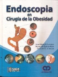 Endoscopia en Ciruga de la Obesidad