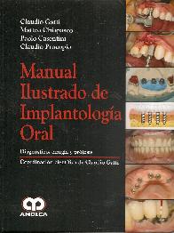 Manual Ilustrado de Implantologa Oral