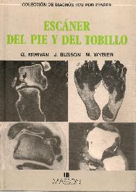 Escaner del pie y el tobillo