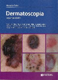 Dermatoscopia