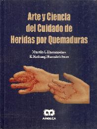 Arte y Ciencia del Cuidado de Heridas por Quemaduras