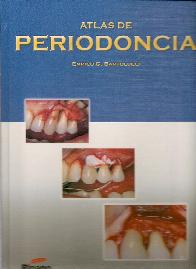 Atlas de Periodoncia