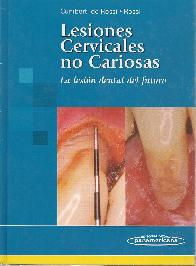 Lesiones Cervicales No Cariosas