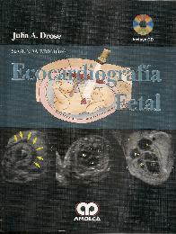 Ecocardiografa Fetal