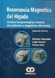 Resonancia Magntica del Hgado