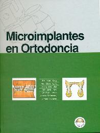 Microimplantes en ortodoncia