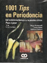1001 Tips en Periodoncia