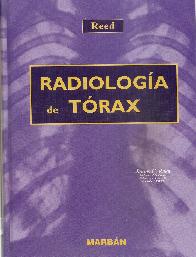 Radiologa de Trax