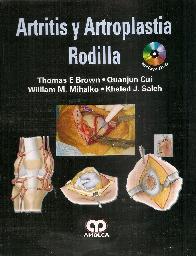 Artritis y Artroplastia Rodilla