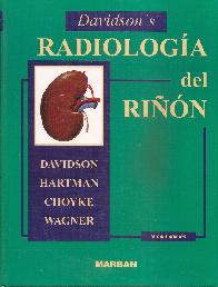Radiologa del rin Davidson' s