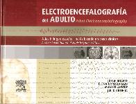 Electroencefalografa del Adulto