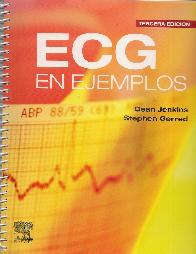 ECG en Ejemplos