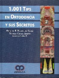 1001 Tips en Ortodoncia y sus Secretos