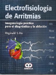 Electrofisiologa de Arritmias